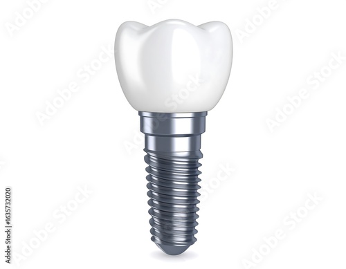 Dental implant