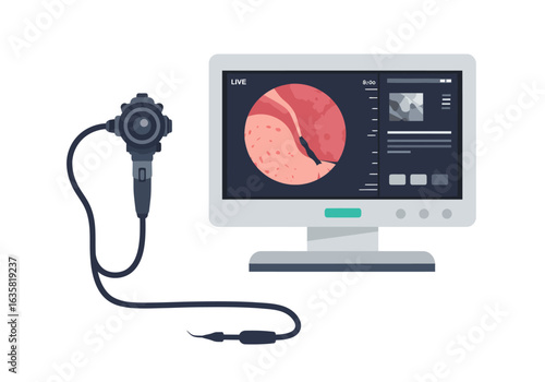Endoscopy System with Monitor Displaying Internal Organ View.