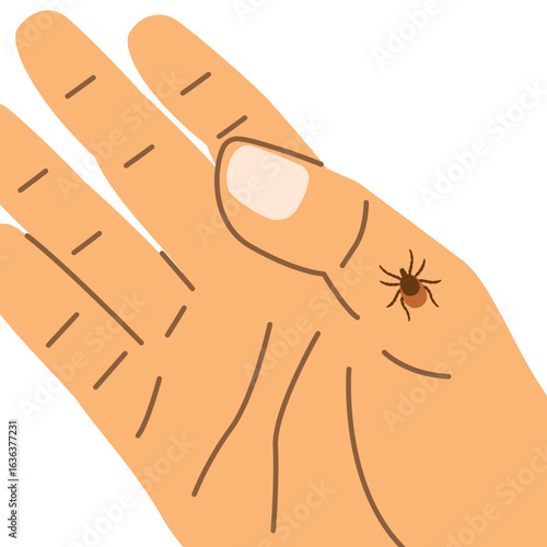 tick on the hand; perfect for educational materials, medical guides, pest control campaigns, disease prevention infographics - vector illustration