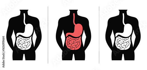 Diagram illustrating the human digestive system with emphasis on the stomach and intestines