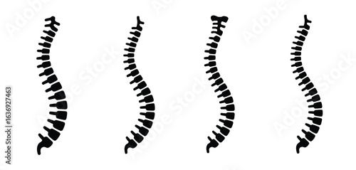 Four stages of spinal curvature progression illustration
