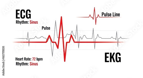 Detailed Medical Infographic of ECG and Pulse with Normal Sinus Rhythm