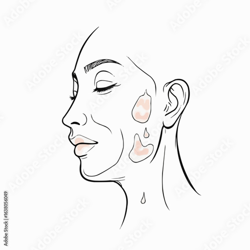 Line art vector of woman showing skin sensitivity with dry patches  