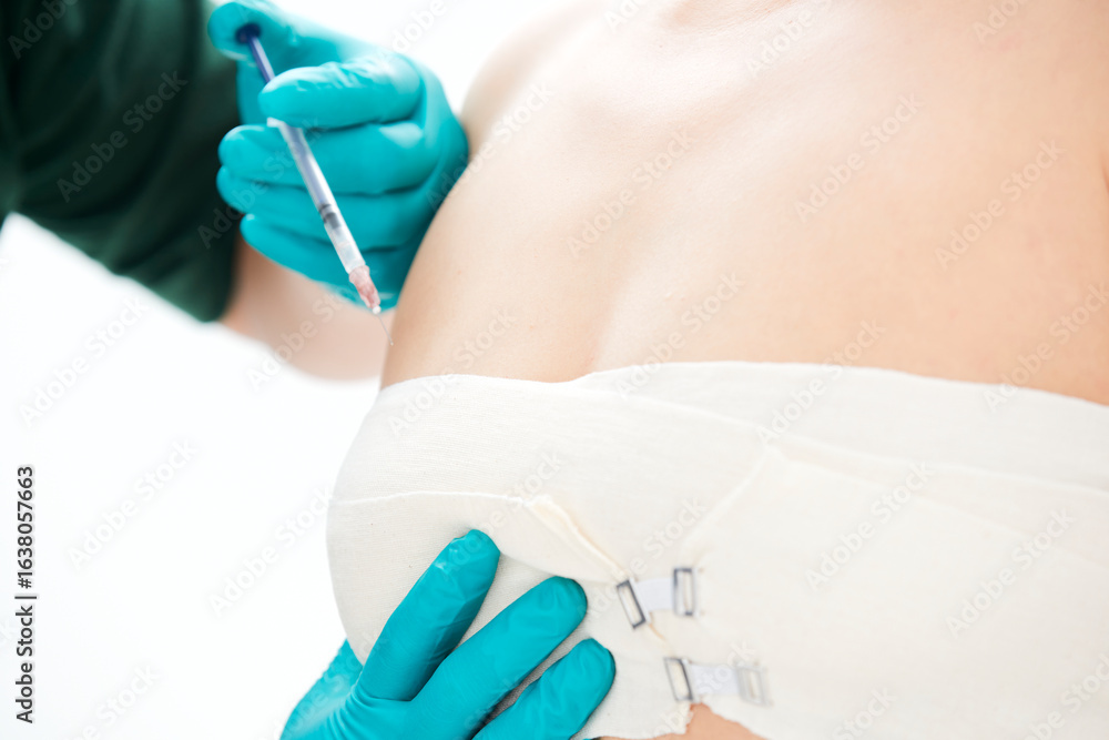 Fototapeta premium Medical aesthetic body contouring injections and examinations