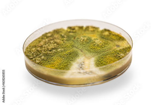 Medical themes: Petri dish showing aspergillus fumigatus