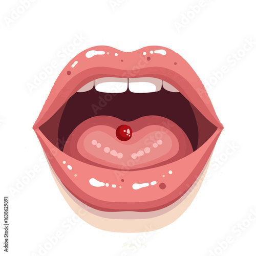 Vector illustration of mouth ulcer close-up on white background