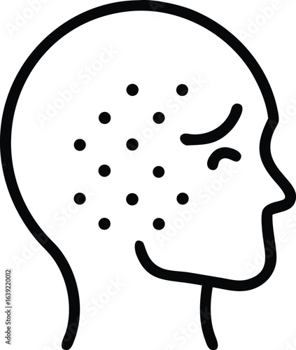 Skin Rash Medical Condition Affecting the Face