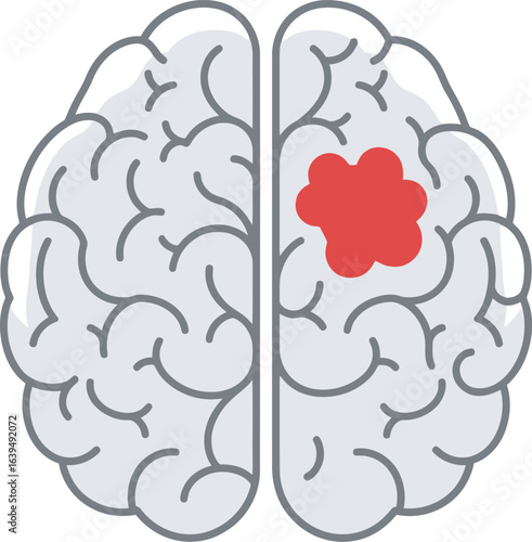 A stylized illustration of a human brain, highlighting a red mass representing a tumor or abnormality.