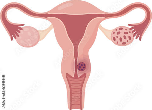 Diagram of the female reproductive system highlighting potential abnormalities.