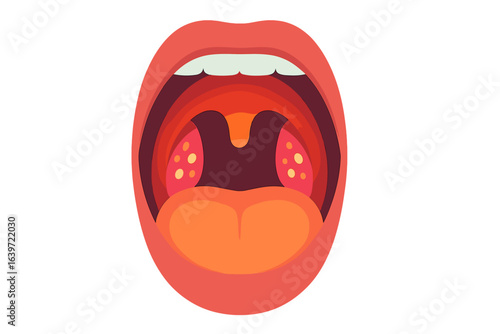 Open human mouth with visible tongue and tonsils illustration inflamed throat close-up