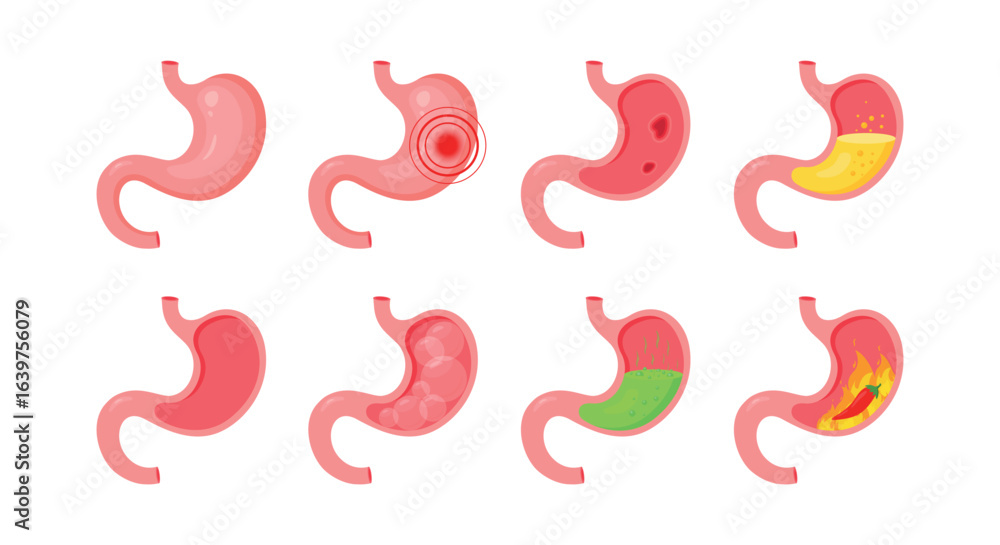 Human stomach. Healthy and unhealthy, empty and full human stomach. Bloating stomach ache, digestive tract pain fullness heaviness stomaches acid heartburn process indigestion Human stomach. Healthy and unhealthy, empty and full human stomach. Bloating stomach ache, digestive tract pain fullness heaviness stomaches acid heartburn process indigestion