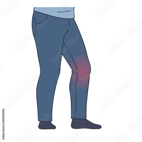 Vector illustration of man with knee swelling on white background