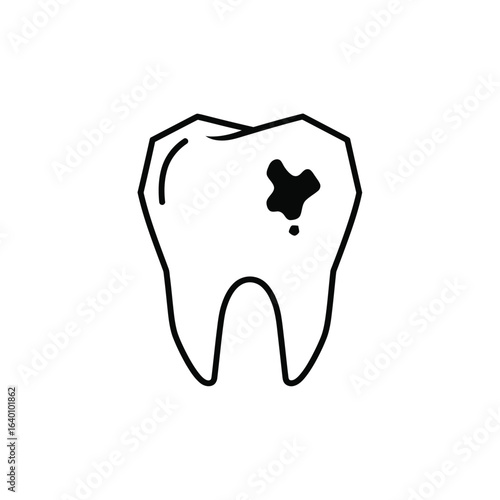 A simple black and white illustration of a molar tooth with a cavity, showing dental decay.