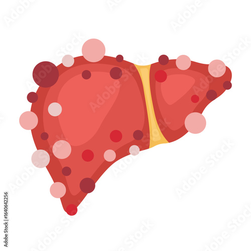 liver hepatitis virus infection concept