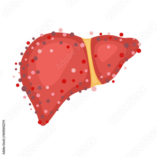 liver hepatitis virus infection concept