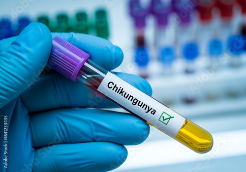 Positive chikungunya test blood sample held in gloved hand