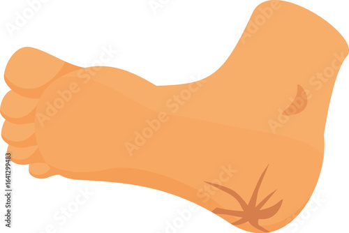Cracked heel showing dry skin on foot, concept of healthcare and dermatology