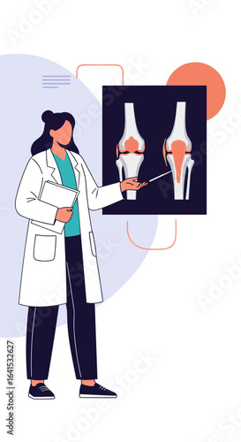Doctor explains knee joint anatomy and osteoarthritis progression diagram