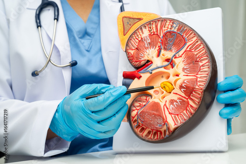 Chronic kidney disease, doctor with model for treatment urinary system, urology, Estimated glomerular filtration rate eGFR.