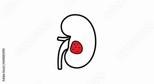 Kidney with Red Lesion, Medical Illustration