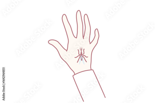 Close up of mosquito bite hand. Bug or insect biting person leave spot or mark. Healthcare and nature. Vector illustration.