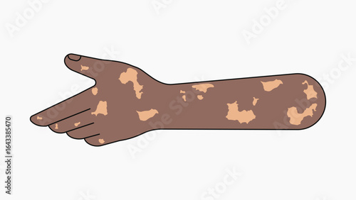 Reaching vitiligo hand, gesture collage element vector