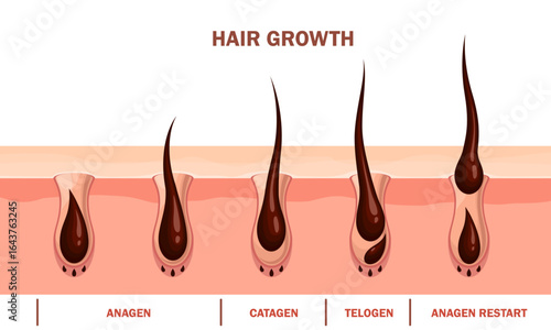 Hair growth cycle vector cross section infographics. Anagen, active growth, catagen transitional, telogen resting and anagen restart phases. Hair follicles undergo continuous regeneration stages