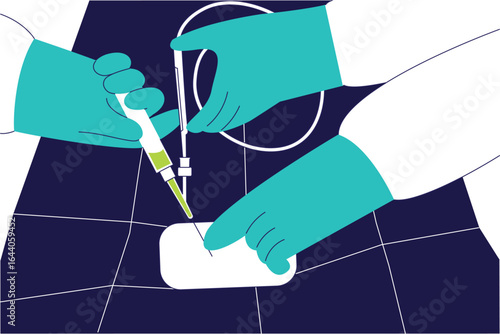 Vascular surgery concept illustration showing a medical doctor performing vein and artery treatment, healthcare and surgery vector.