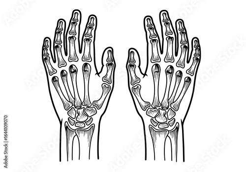 Illustration of human hands showing anatomy and joints affected by arthritis