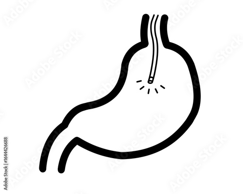 胃カメラ　イラスト