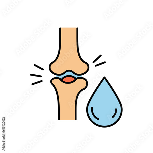 Arthritis Illustration: A detailed medical illustration highlighting the effects of arthritis, showcasing the joint's affected area, emphasizing the crucial concept of health.