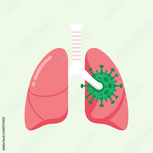 Illustration of lungs with viral infection causing respiratory disease symptoms and breathing difficulties