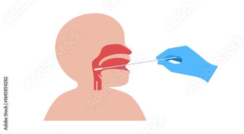 Swab throat procedure