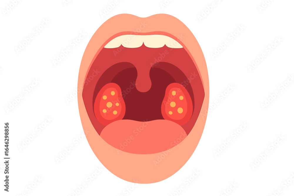 Fototapeta premium Human mouth illustration showing tonsils and throat anatomy inflamed tonsils