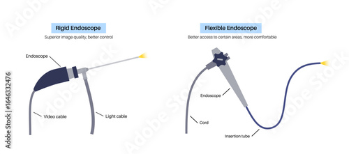 Nasal endoscopy poster