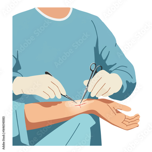 A flat 2D vector illustration depicts a skilled surgeon carefully stitching a wound on a patient’s arm, holding a needle holder tool against a clean white background.