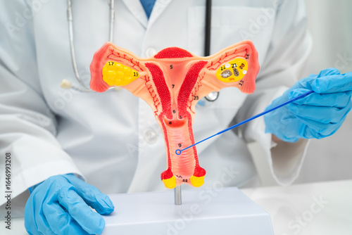 Photography Doctor holding human uterus model for vaginal and cervix pap smear check up in the obstetrics and gynecology