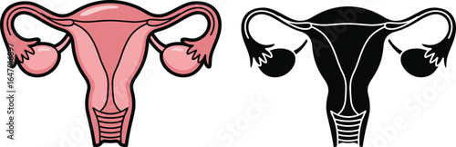 Anatomical human uterus illustration in color and silhouette