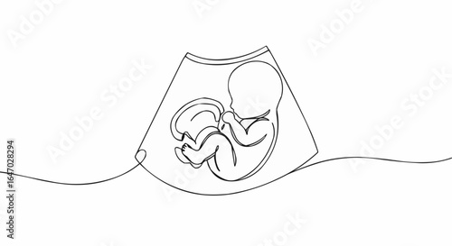 A minimalistic line drawing of a baby within an ultrasound scan.