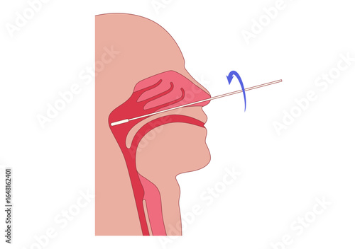 Nasopharyngeal swab procedure