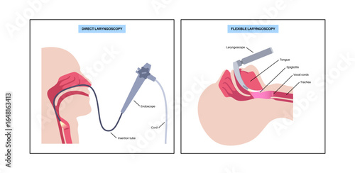 Laryngoscopy medical procedure