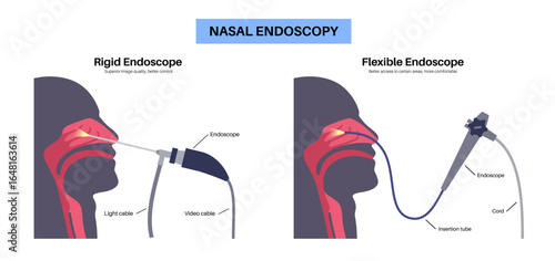 Nasal endoscopy poster