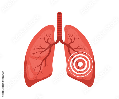 Lungs pain. Human internal organ disease. Lungs medical diagnosis and treatment. Vector illustration in flat cartoon style.
