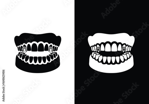 Black and white illustration of a set of dentures with visible metal clasps on the upper and lower jaw.