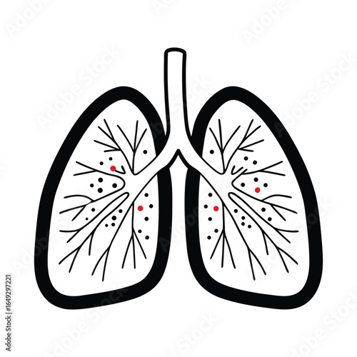 Human lungs with red spots and black dots illustration