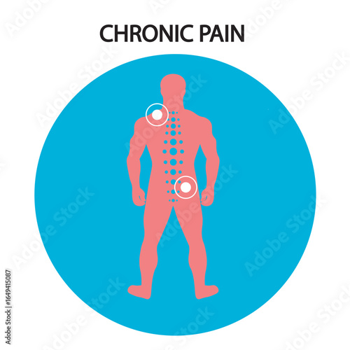 Flat vector illustration of chronic pain showing persistent aches, fatigue, stiffness, and mood changes, often confused with fibromyalgia, arthritis, or neuropathy. silhouette icon