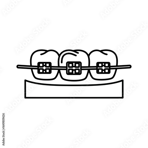 Orthodontic braces on teeth, dental care and treatment for teeth straightening and alignment, isolated on white background, vector illustration