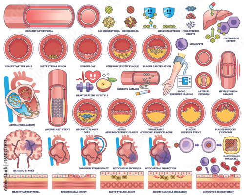 Atherosclerosis and cardiovascular disease are illustrated with artery cross-sections, heart diagrams, and plaque buildup. Outline style worksheet collection