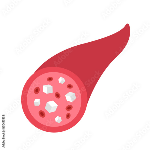 diabetes disease concept. sugar in blood vessel