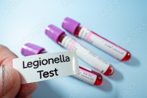 A gloved hand holds a blood sample tube labeled 